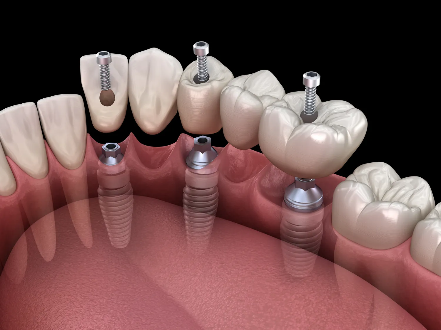 Jak pokonać lęk przed dentystą?